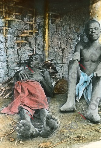 Kranke Eingeborene | Sick natives - Foto foticon-simon-192-020.jpg | foticon.de - Bilddatenbank für Motive aus Geschichte und Kultur